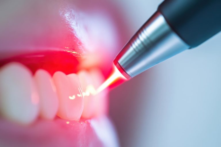 durata di una seduta di parodontologia laser durata di una seduta di parodontologia laser