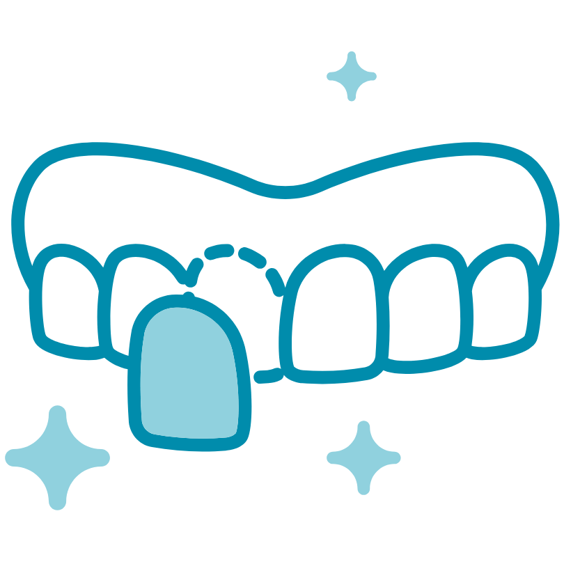 Protesi 45 Faccette dentali a Varese - Studi Dentistici dr Ernesto Cappelletti